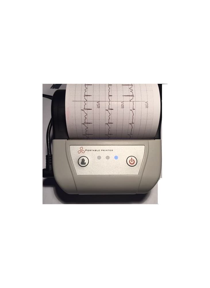 Imprimante portable pour aECG