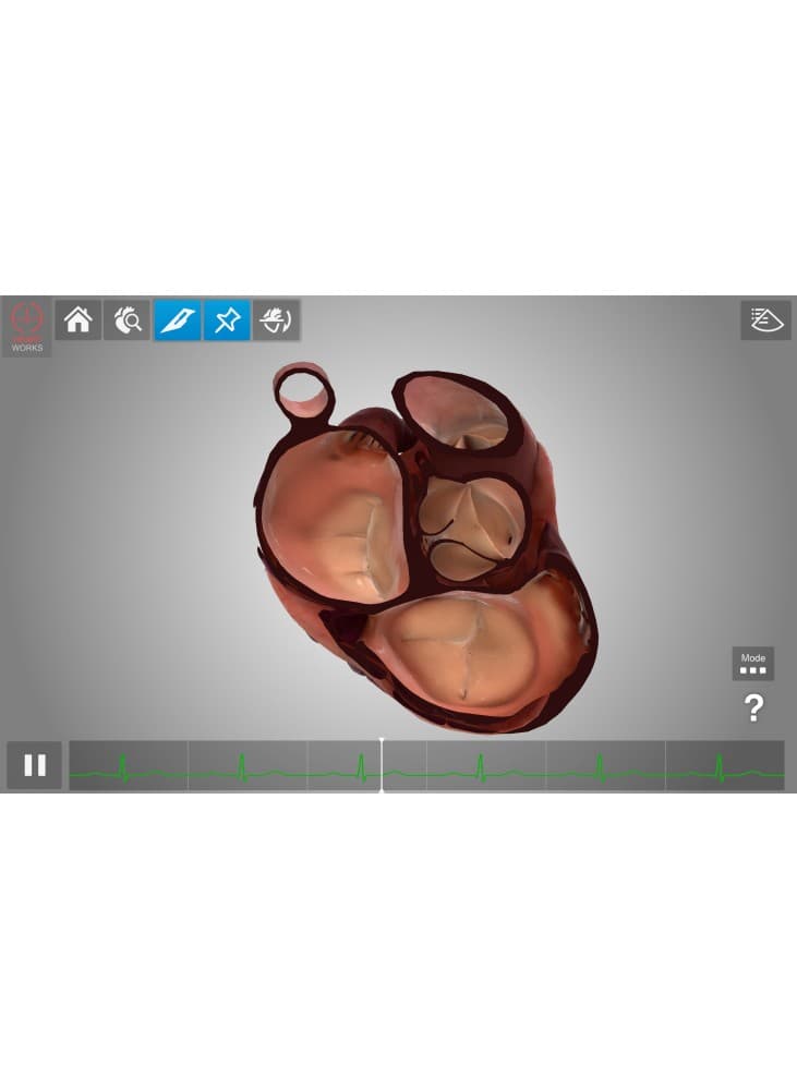 Tablette HeartWorks AR